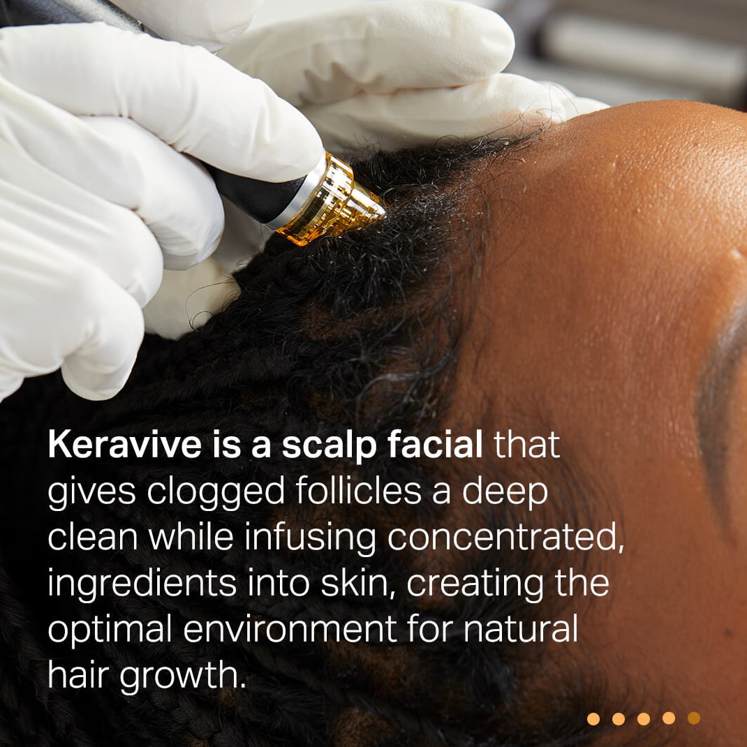 Keravive Scalp Treatment Unclo